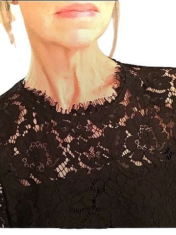 Rachel Zoe Casual Dress (view 2)